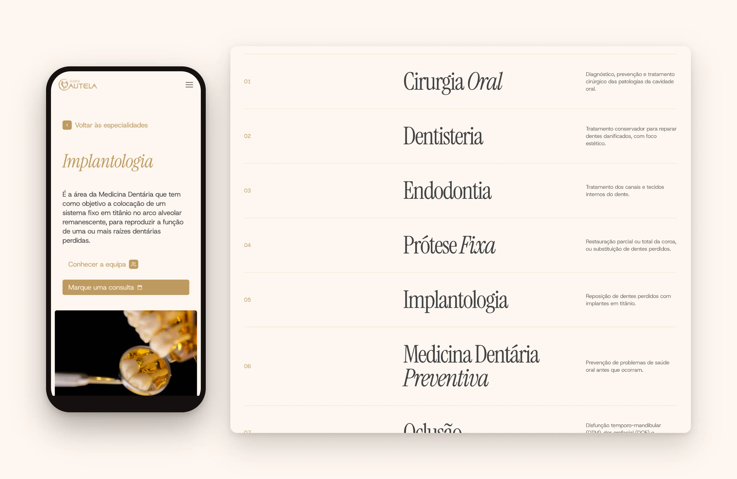 Clínica Cautela specialties: the implantology page on mobile and the list of thirteen specialties