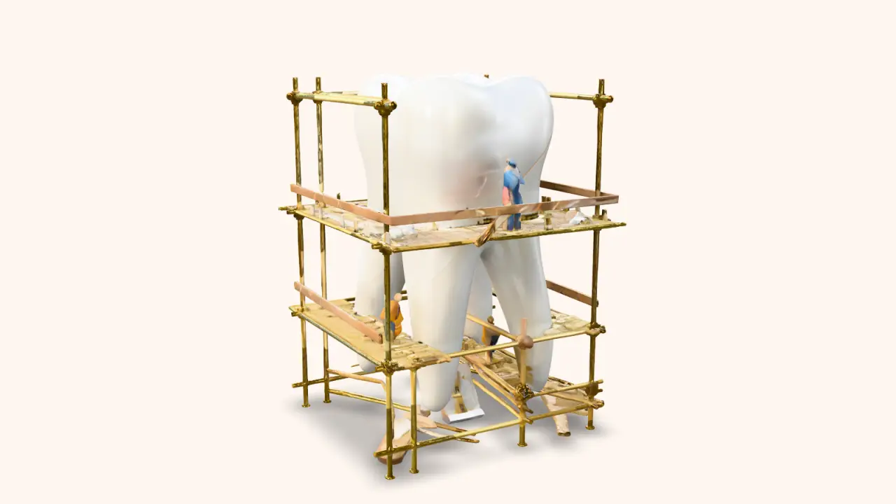 Tooth sculpture with scaffolding from Clínica Cautela’s 3D digital museum